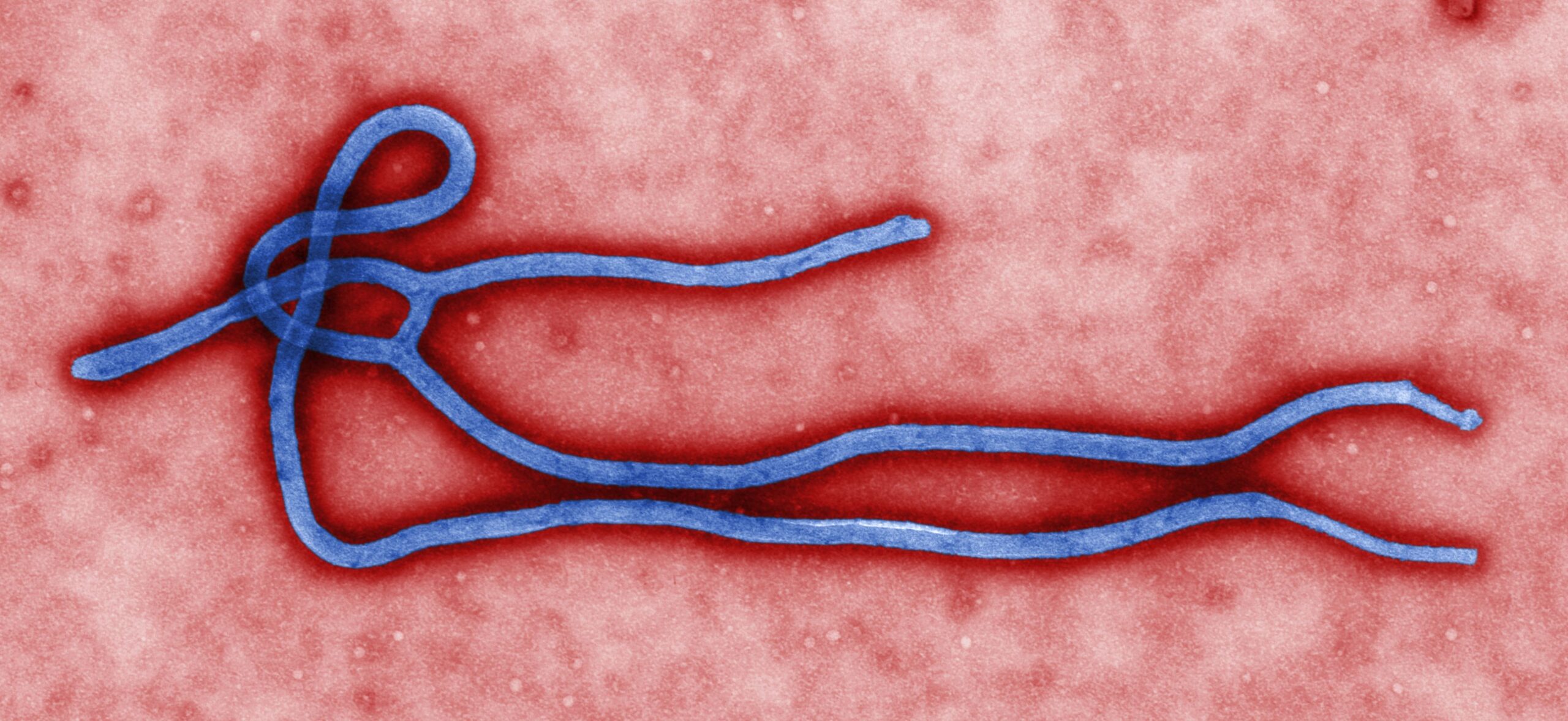 The Ebola Response Has a Payroll Problem, and It Is Costing Lives