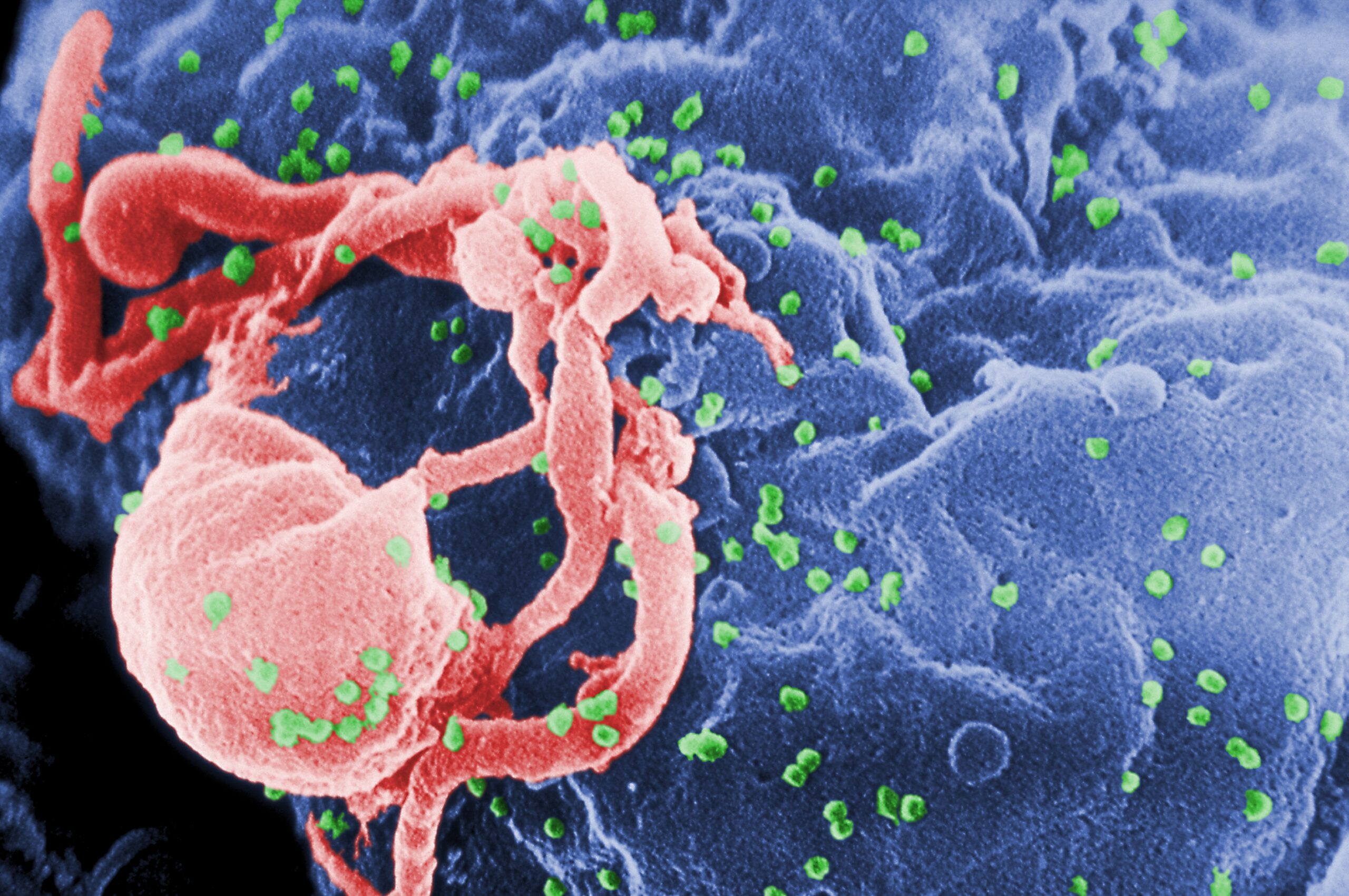 A Triple Therapy Cleared HIV in Infant Macaques. What That Does and Doesn’t Mean.