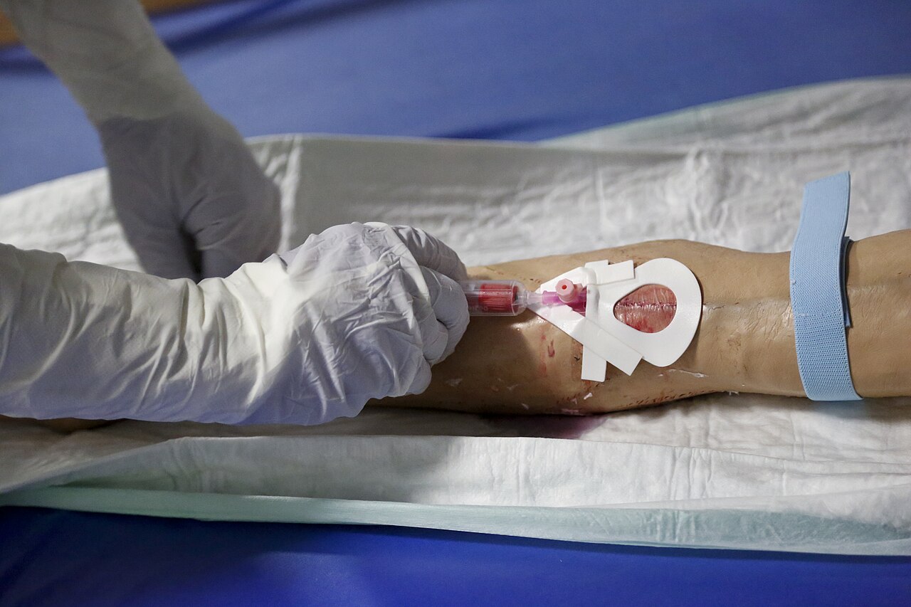 The Second-Largest Ebola Outbreak Ever, and No Vaccine for It